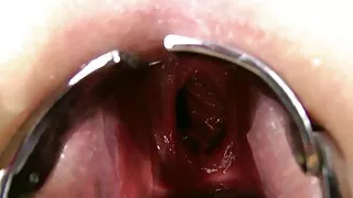 সুস্বাদু খুঁজছেন শ্য ...