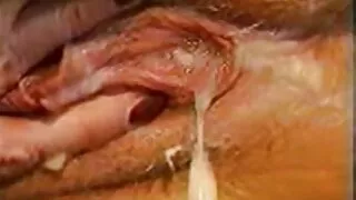 পায়ু উন্মাদ শ্যামাঙ ...